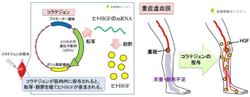 コラテジェン(遺伝子治療用製品)